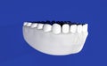 Jaw, cast of teeth, human teeth. Dentistry, periodontist. 3D-rendering