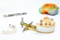 Jaw model with dental implants and ceramic crowns. in the background is a dental impression with implantation tools. the process Royalty Free Stock Photo