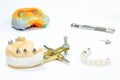 jaw model with dental implants and ceramic crowns. in the background is a dental impression with implantation tools Royalty Free Stock Photo