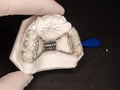 Jaw with orthodontic expand retainer