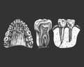 115_ jaw, teeth, gums, palate_dental implant_tooth structure, graphics