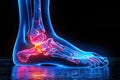 Joint diseases, hallux valgus, plantar fasciitis, heel spur, woman\'s leg hurts, pain in the foot