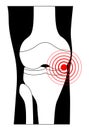 Joint pain icon. knee osteoarthritis