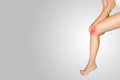 Joint pain. Pain in knee. Closeup of beautiful female leg with painful knees. Close-up of woman feeling joint pain, having health Royalty Free Stock Photo