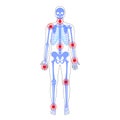 Joint pain on skeleton in human body