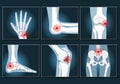 Joints Set icons like x-ray image Royalty Free Stock Photo