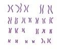 Karyotype of Angelman syndrome