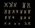 Karyotype of Angelman syndrome