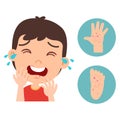 Kid boy is hand foot mouth disease Royalty Free Stock Photo