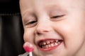 Kid patient open mouth showing caries teeth decay. Dental medicine and healthcare. caries from an early age Royalty Free Stock Photo