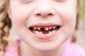 Kid shows off first missing tooth. Children without one tooth smiles Royalty Free Stock Photo