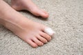 Kid teenager bare foot with a bandage on a toe, wounded toe or ingrown nail first aid Royalty Free Stock Photo