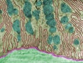 Kidney. Basal inholdings