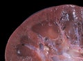 Kidney. Close-up Royalty Free Stock Photo