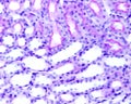 Kidney. Convoluted tubules. Periodic acidÃ¢â¬âSchiff PAS method