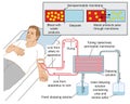 Kidney dialysis