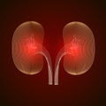 Kidney disease silhouette icon. Stones in the kidneys. Pyelonephritis. Urolithiasis disease