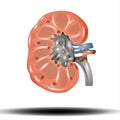 Kidney - internal organ, Kidney stones. Renal calculi, nephrolithiasis or urolithiasis, vector illustration on white Background