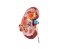 Kidney model isolated on white background with clipping path. Chronic kidney disease, treatment urinary system, urology, Estimated