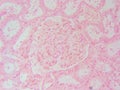 Kidney\'s Star: Single Glomerulus Closeup at 400x