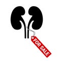 Kidney is for sale