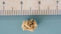 KIDNEY STONE 9mm Royalty Free Stock Photo