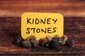 Kidney stones Royalty Free Stock Photo