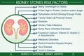 Kidney Stones Disease Risk Factors Infographic Vector Illustration Royalty Free Stock Photo