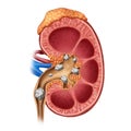 Kidney Stones Royalty Free Stock Photo