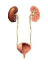 Kidney and urinary stones