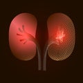 Kidneys with a point of pain. Stylized transition from a real organ to an X-ray effect. Medical illustration of kidney