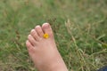 Kids bare feet with yellow flower on the grass