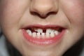 Kids teeths - closeup look