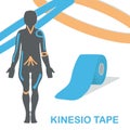 Kinesio tape improves nerve receptors and reduces pain. Royalty Free Stock Photo