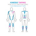 Kinesio taping. How using and how to cut the kinesiology tape