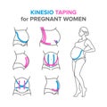 Kinesio taping for pregnant women