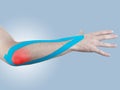Kinesio tex tape therapeutic treatment of the elbow Royalty Free Stock Photo