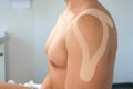 Kinesiology tapes on man& x27;s shoulder and hand for fixation of muscles, closeup.