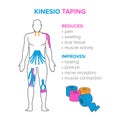 Kinesiology taping. Reduses and improves Royalty Free Stock Photo