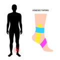 Kinesiology therapeutic tape