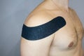 Kinesiotaping, kinesiology tape - application for back pain Royalty Free Stock Photo