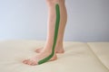 Kinesiotaping Medicine Rehabilitation on a woman