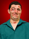 Kissed man Royalty Free Stock Photo