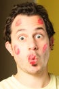Kissed man Royalty Free Stock Photo