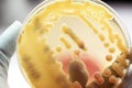 Klebsiella pneumoniae colonies as test on MacConkey agar plate.