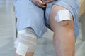 Knee with adhesive and gauze bandage.