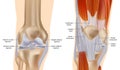 Knee anatomy including ligaments, cartilage and meniscus. Muscles and Tendons. Detailed Anatomy of the Knee Joint.