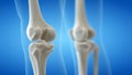 The knee bones
