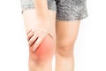 Knee bones pain