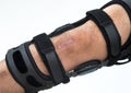 Knee Brace. Royalty Free Stock Photo